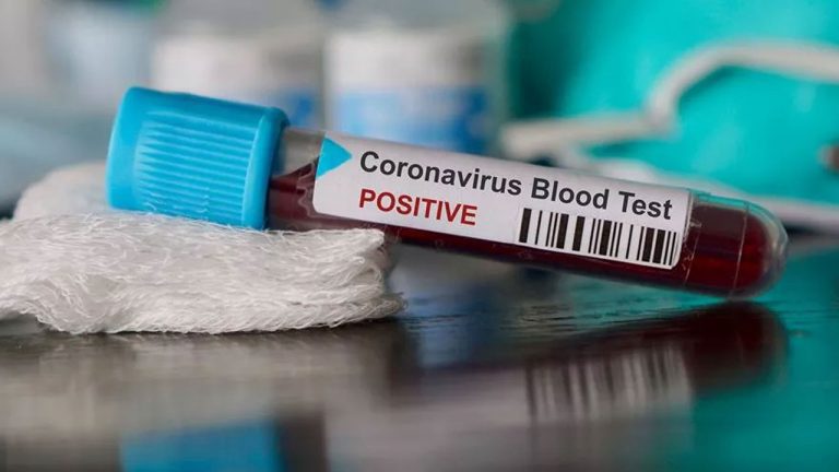 Coronavirüs gazeteciliğe de bulaştı